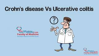 Colitis ulcerosa Vs Enfermedad de Crohn [upl. by Nosidam]