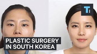 Plastic surgery in South Korea [upl. by Juli]