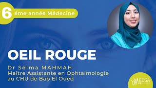 ŒIL ROUGE  Dr Selma MAHMAH [upl. by Rebme]