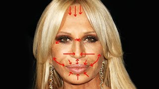 Removing DONATELLA VERSACES Plastic Surgery [upl. by Hills876]