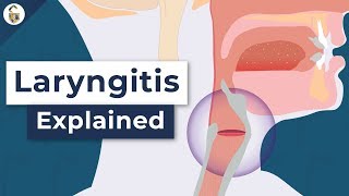 Why Do You Lose Your Voice  Laryngitis Explained [upl. by Valerle]