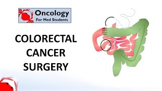 Colorectal Cancer Surgery principles and types [upl. by Hnoj738]