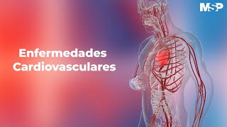 Enfermedades cardiovasculares [upl. by Ayot]