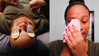 How To Use Tea Bags for Puffy Eyes DIY to Reduce Dark Circles amp Swollen Eyes [upl. by Goggin]