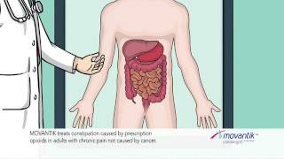 Movantik quotopioid baggagequot commercial [upl. by Bihas]