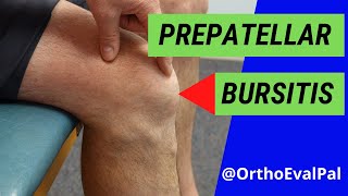 Prepatellar Bursitis Anterior knee pain and swelling [upl. by Melar]