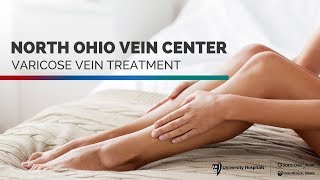 Varicose Vein Treatment  Steves VenaSeal Story [upl. by Yenial]