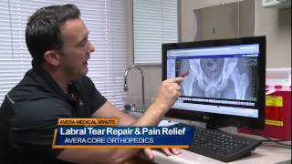 Labral tear repair and pain relief  Medical Minute [upl. by Baggett428]