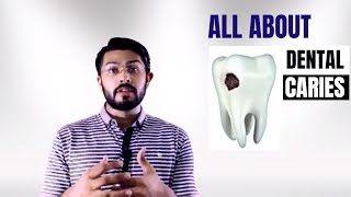 Dental Caries explained EASY [upl. by Mela]