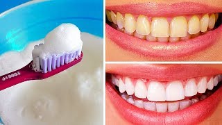 10 Natural Ways to Whiten Teeth at Home [upl. by Aikemat861]