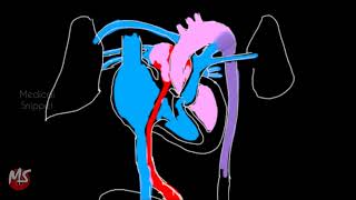 Fetal Circulation  Anatomy  Made easy  3 minutes [upl. by Kidder]