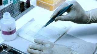 DNA Fragmentation Test Procedure  Sperm360 [upl. by Nodlehs]