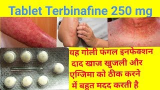 Tablet Terbinafine 250 Mg Full Review In Hindi  Uses  Dose  Side Effects Tarbinafine Tablet Uses [upl. by Cut]