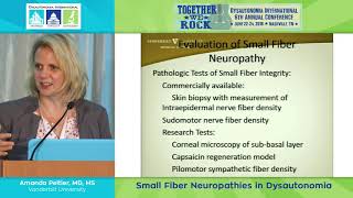 Immune Mediated Neuropathies  Multifocal Motor Neuropathy  Neurology Lectures  VLearning [upl. by Idieh]