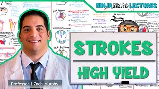 Intracerebral Hemorrhage ICH Etiology Pathophysiology Clinical Features Diagnostics Treatment [upl. by Chouest]