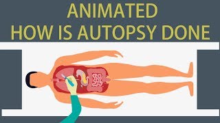 Autopsy Detailed animation on how is Autopsy done [upl. by Oinota]