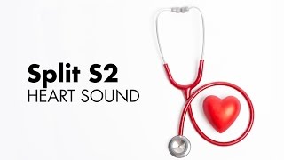 Fixed Split S2  Heart Sounds  MEDZCOOL [upl. by Krusche]