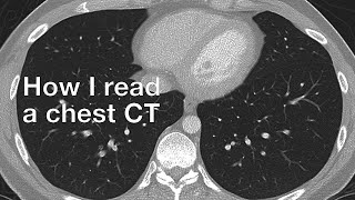 How I Read a Chest CT [upl. by Mattox]