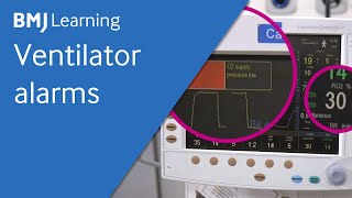 Ventilator alarms  BMJ Learning [upl. by Adnilev269]