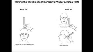 Interpreting the WeberRinne Tests EXPLAINED [upl. by Avilo431]