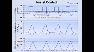 Ventilator Modes Mechanical Ventilation  Lecture 7 [upl. by Connell]