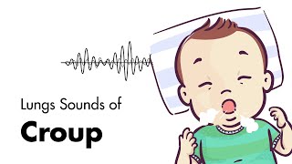 Sounds of Croup Laryngotracheitis  Lung Sounds  MEDZCOOL [upl. by Anthony]