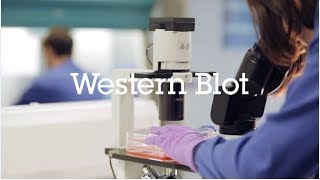 Western blot protocol video [upl. by Soren365]