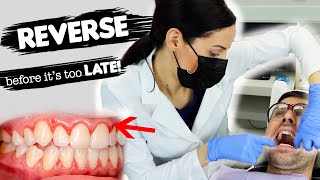 How To Treat Gum Disease [upl. by Borgeson]