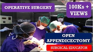 OPEN APPENDECTOMY STEP BY STEP OPERATIVE SURGERY [upl. by Atul375]