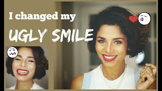 How to IMPROVE AWKWARD SMILE into PICTURE PERFECT Smile Without Dentist GIVEAWAY [upl. by Ardnek]