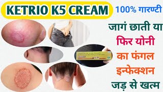 Dad khaj kujali ki sabse acchi cream KETRIO K5 CREAM review KETRIO K5 CREAM ketriok5creamkt5derm [upl. by Aynahs833]