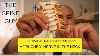 CERVICAL STENOSIS RADICULOPATHY PART 1  SYMPTOMS IMAGING AND PATIENT EXAM [upl. by Colston]