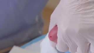 CLSI Newborn Screening DVD  Informational Video Trailer [upl. by Mihe]