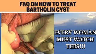 How to prevent Bartholin Cyst from Getting Abscessed  How to treat Bartholin Cyst while pregnant [upl. by Meli]