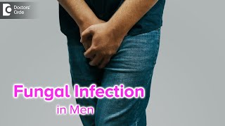 Fungal infection in Men Causes amp Treatment  Yeast Infection in Men Dr Nischal KDoctors Circle [upl. by Marguerita830]