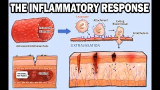 THE INFLAMMATORY RESPONSE [upl. by Cirdes961]