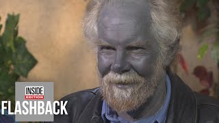 Why This Man’s Skin Turned Blue [upl. by Rillings]