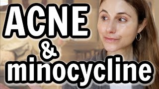 Minocycline versus doxycycline for acne Dr Dray [upl. by Attaynek]