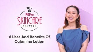 6 Uses And Benefits Of Calamine Lotion  POPxo Skincare Secrets [upl. by Marielle]