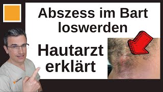 Abszess öffnen im Bart Dr Kasten Hautmedizin in Mainz [upl. by Anivas]