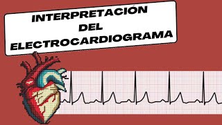 Interpretación del Electrocardiograma [upl. by Neeruam]