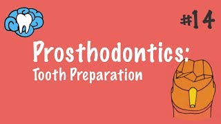 Prosthodontics  Tooth Preparation  INBDE ADAT [upl. by Gersham]