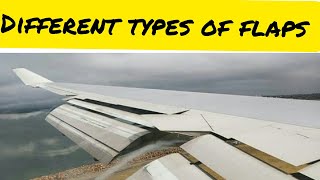 Types of flap [upl. by Paolo642]