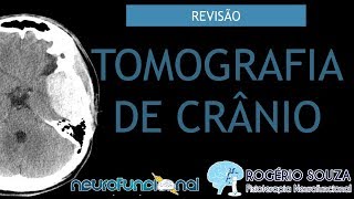 TOMOGRAFIA DE CRÂNIO Vídeo Aula  Rogério Souza [upl. by Kosaka]