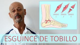 ESGUINCE DE TOBILLO  Lesión de ligamentos [upl. by Eloise]