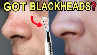 How I Clean Congested Pores on the nose you should have one at home [upl. by Areek]