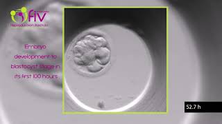 TimeLapse  Embryo development ENG first 100 hours [upl. by Celisse449]