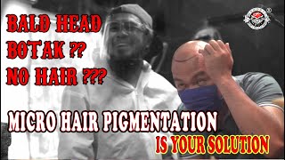 HAIR MICRO PIGMENTATION PROCESS [upl. by Sayer]