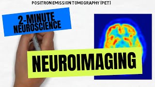 How Does an MRI Scan Work [upl. by Isayg169]