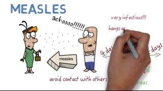 Measles What you need to know [upl. by Moor]